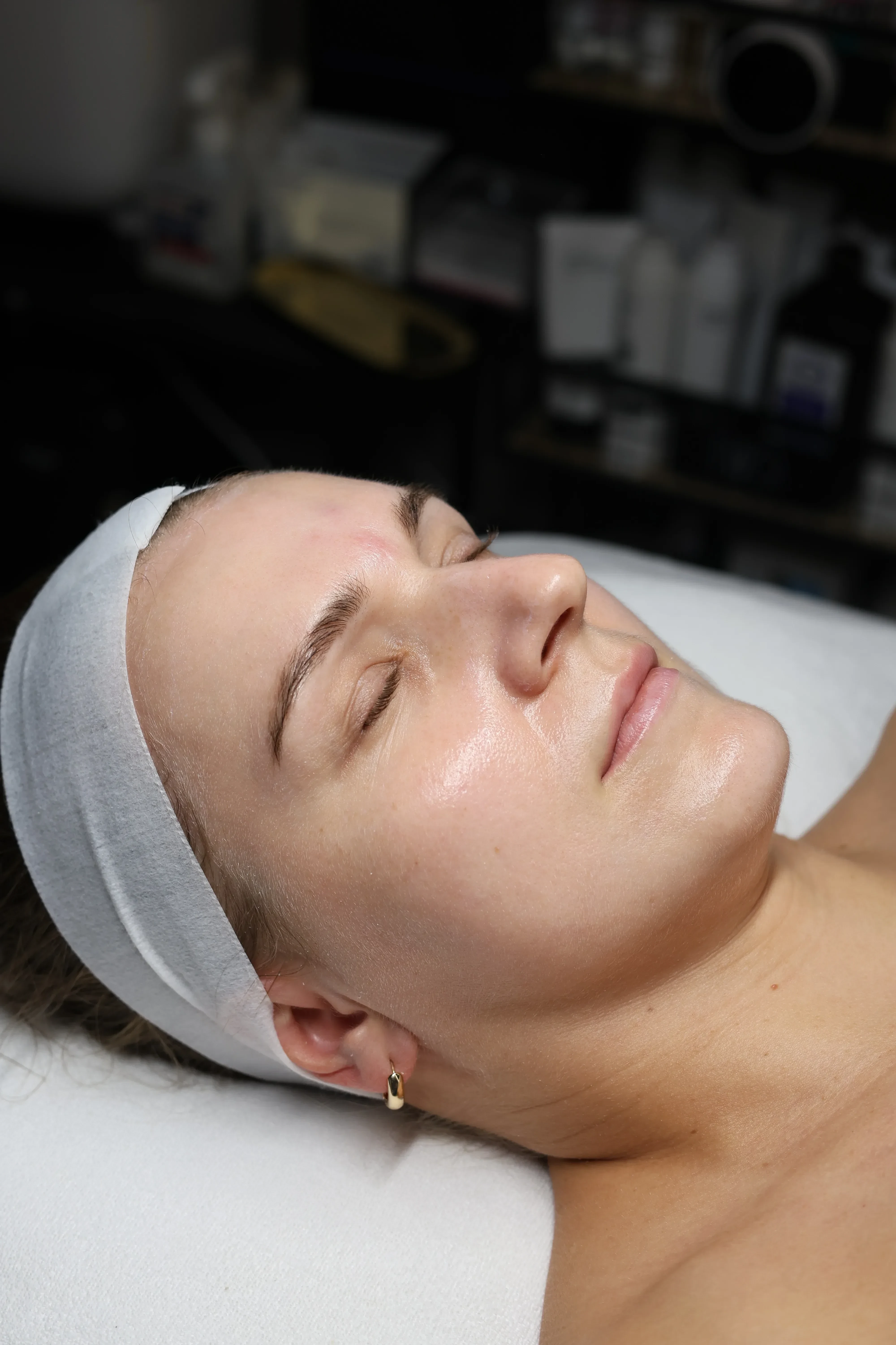 Treatments in Your 20s