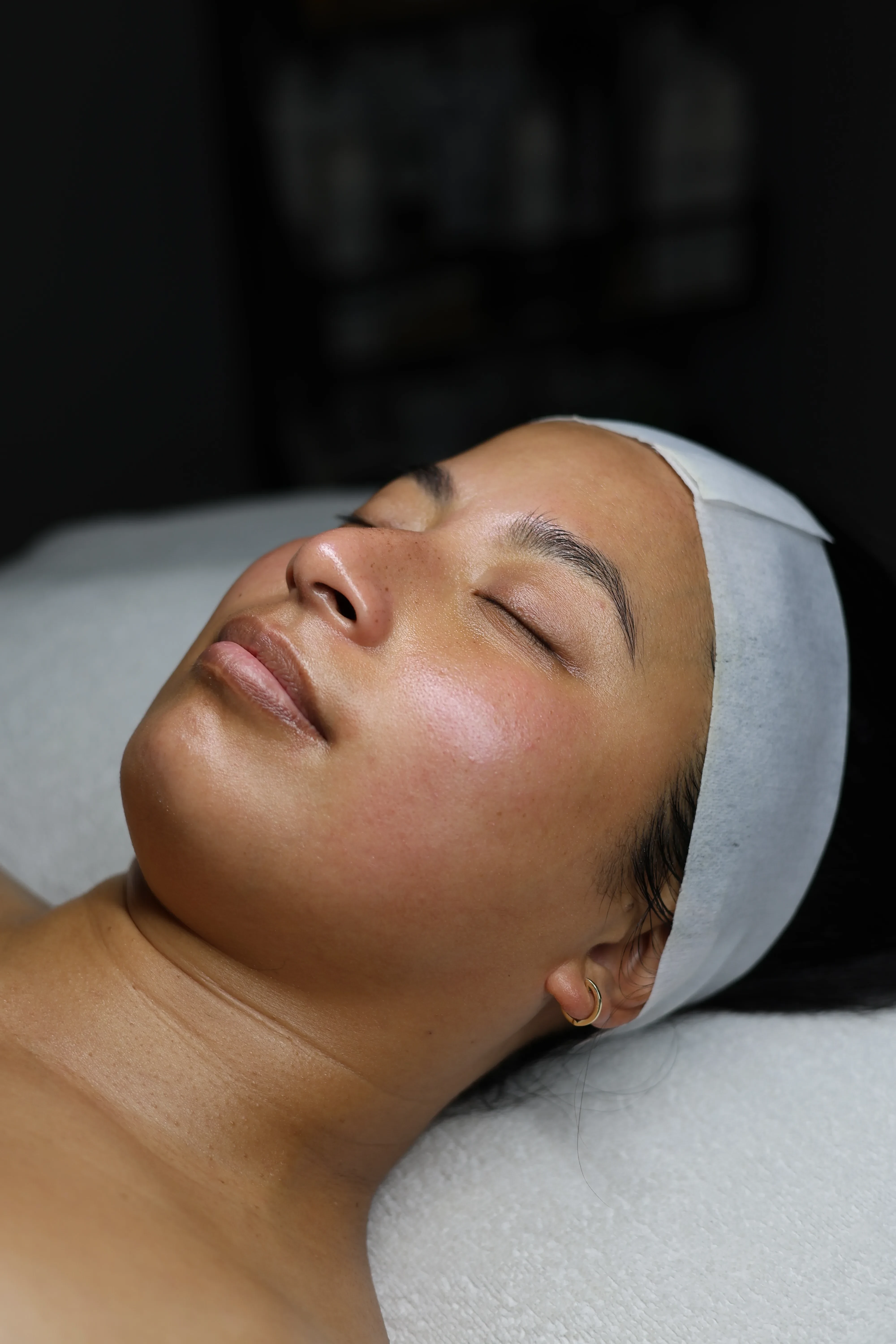 Treatments in Your 30s