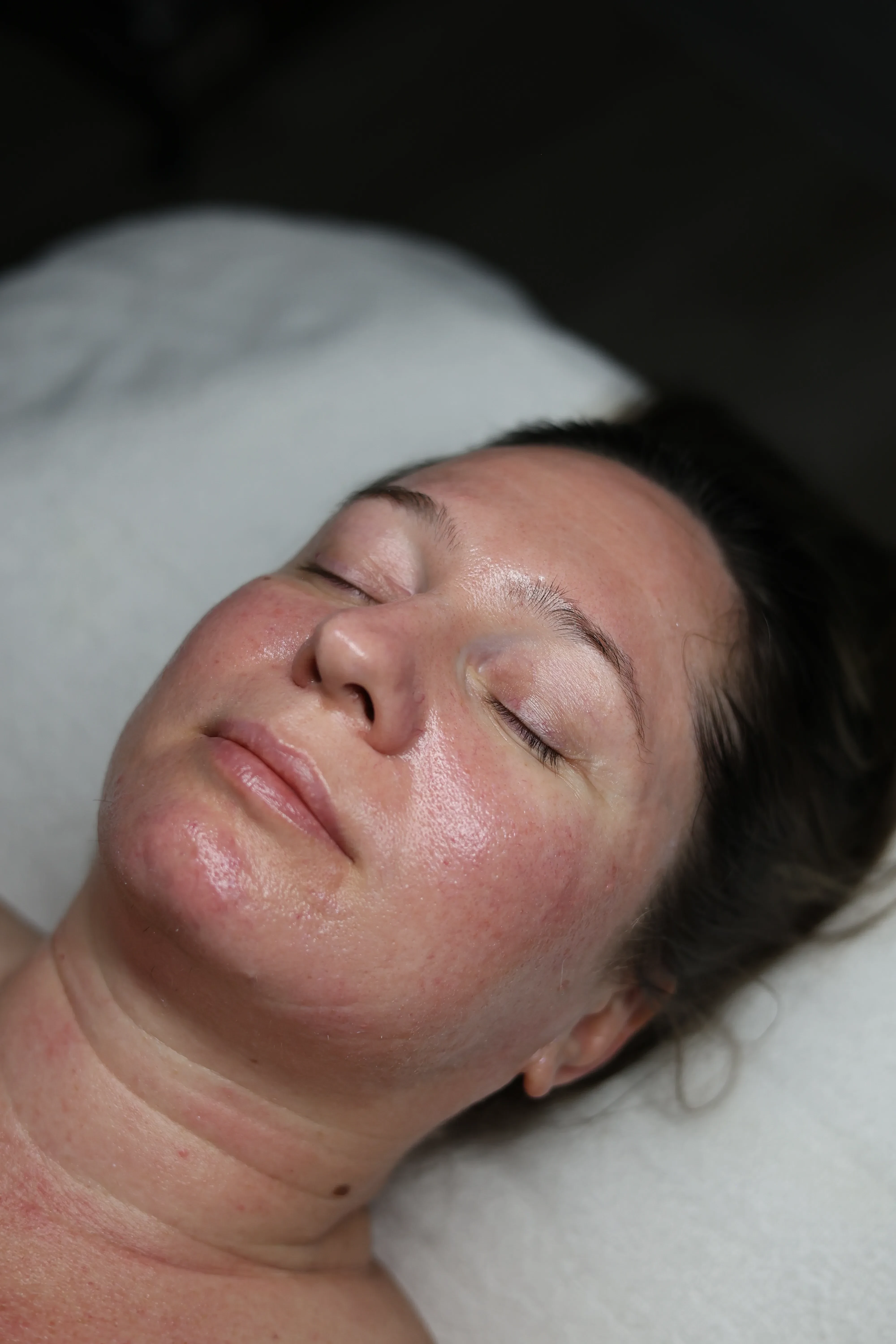 Treatments in Your 40s