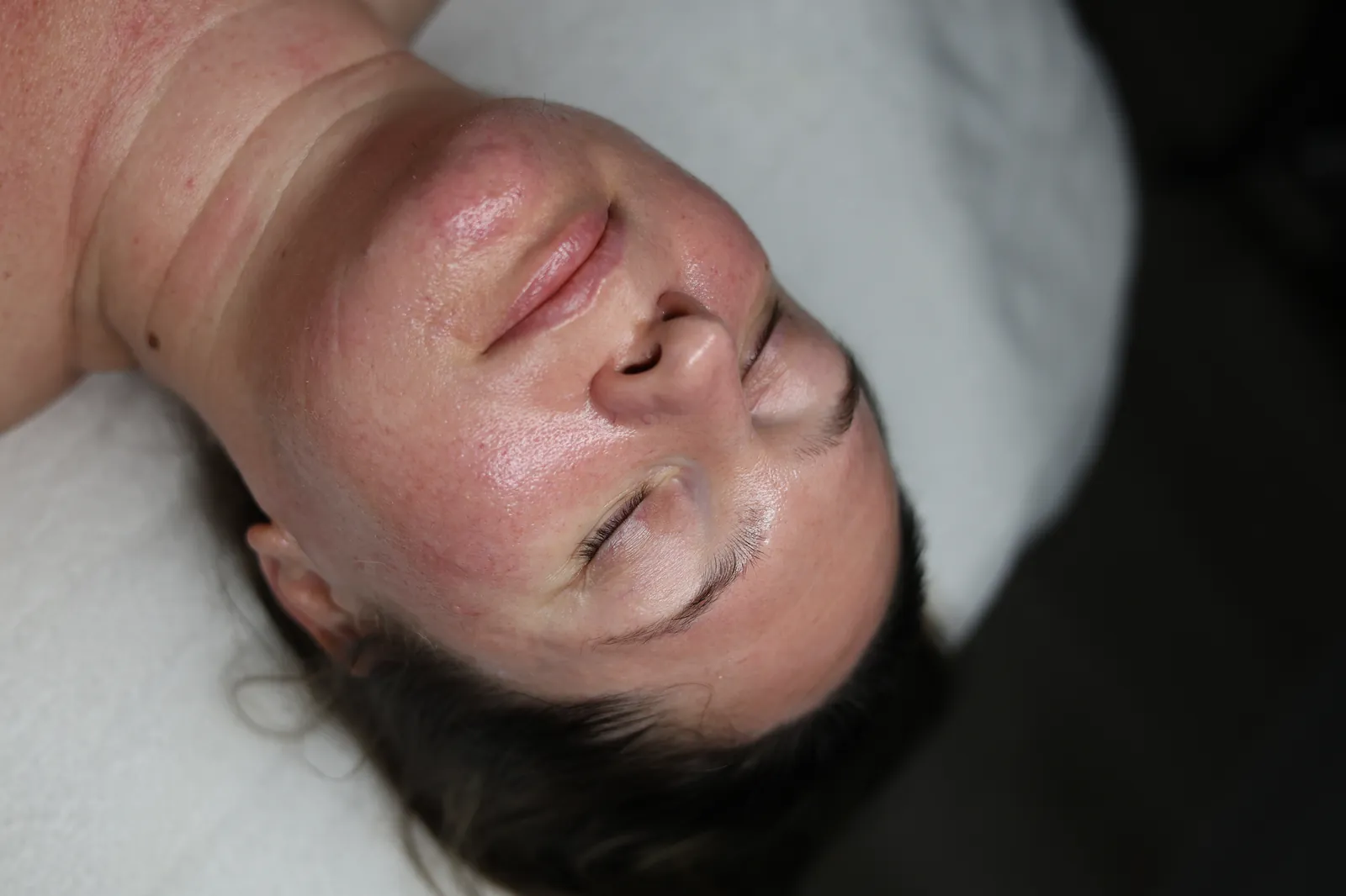 Treatments in Your 40s