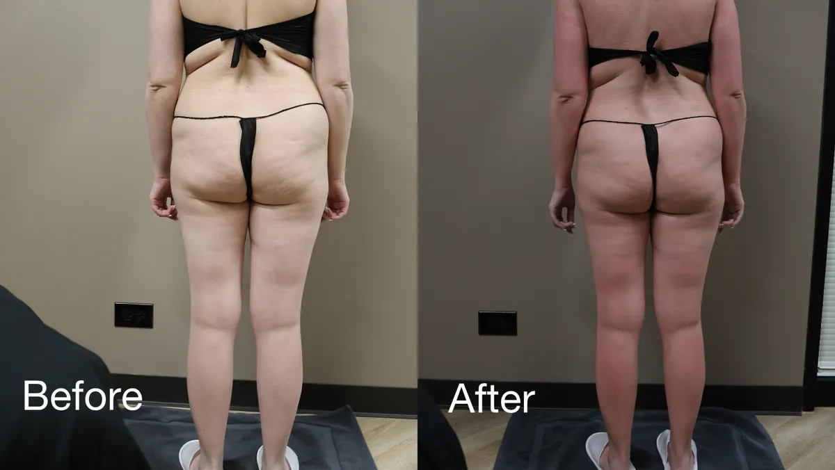 Body Slimming & Wrap