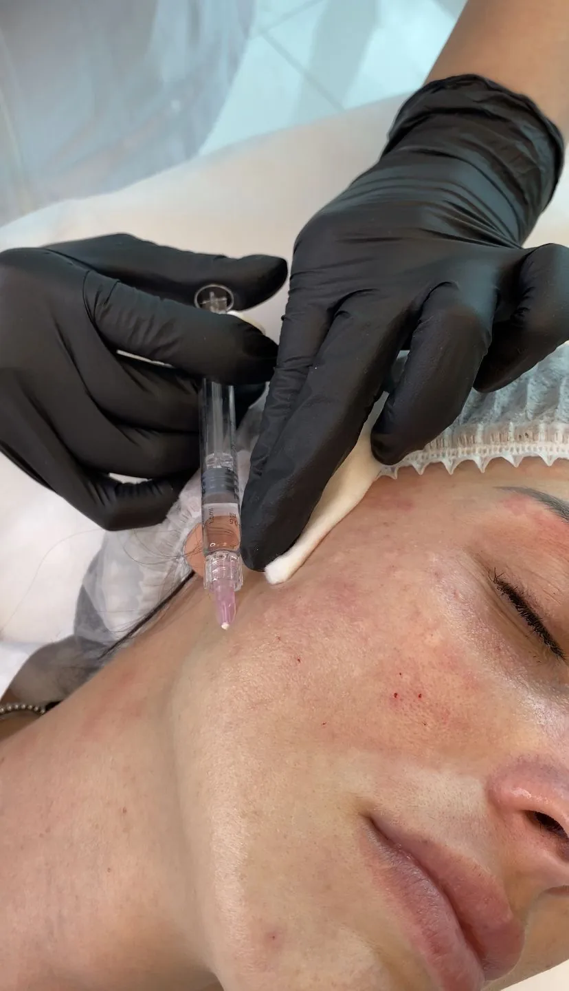 Injectables